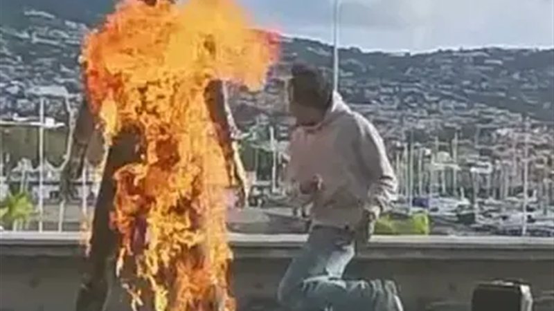 شاب يشعل النار في